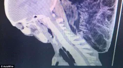 Galerie foto - Poza #4