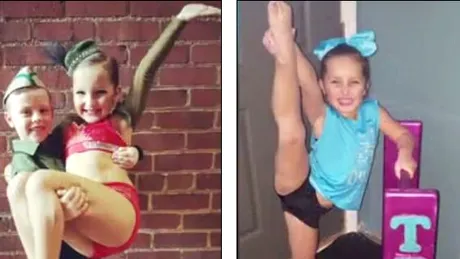 Fetita aceasta de 6 ani si-a pierdut piciorul din cauza unei complicatii la gat. Ce a patit micuta dansatoare