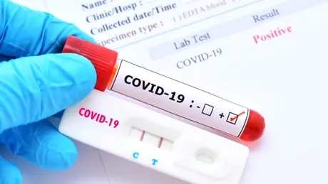România produce primul test rapid de depistare a virusului SARS COV 2. Cum funcționează