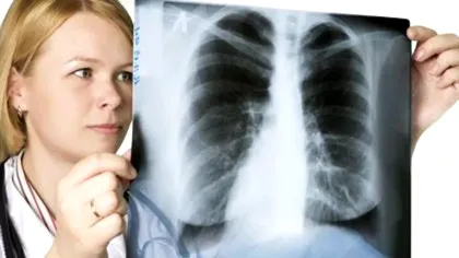 Studiu unic în România. Cercetătorii au descoperit un fenomen alarmant în legătură cu o formă de cancer