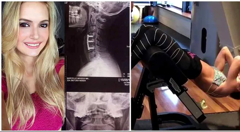 A paralizat dupa ce a facut abdomene!!! Trauma prin care a trecut acest model fitness. I se poate intampla oricui!
