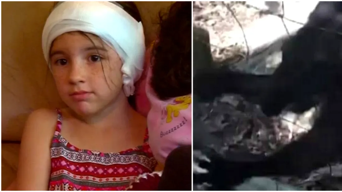 Fetita asta de doar 9 ani a fost atacata de un cangur! Parintii s-au ingrozit cand au vazut ce ii face animalul. Imaginile VIDEO sunt horror
