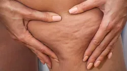 Galerie foto - Poza #4