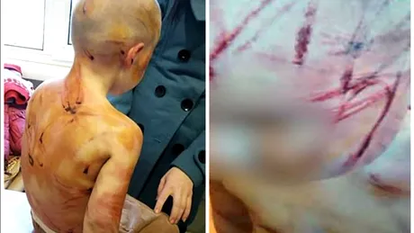 Infiorator! Fetita asta de 4 ani a fost omorata in bataie de iubitul mamei ei pentru ca nu stia sa numere pana la 5