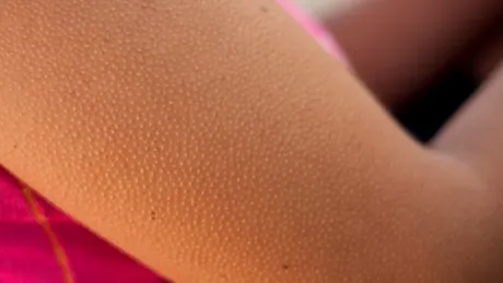 Ce înseamnă dacă ți se face ”pielea de găină” atunci când asculți muzică