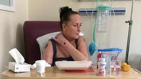 A ajuns de urgenta la spital cu dureri crunte in zona cotului! Cand s-au uitat la mana femeii, medicii au incremenit. Ce au descoperit acestia