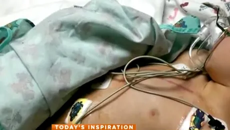 Baietelul asta a fost operat pe inima de 12 ori! Cand s-a trezit din operatie a inceput sa planga in hohote! Povestea lui e unica VIDEO