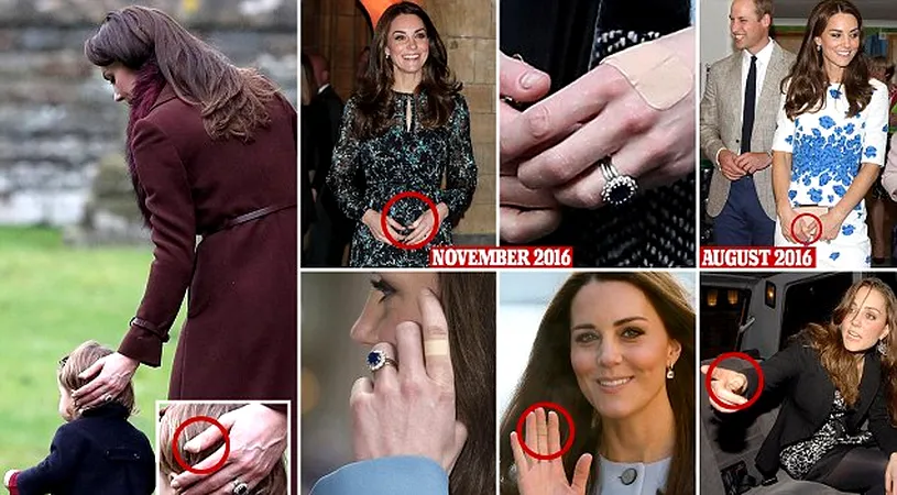 Kate Middleton are tot timpul degetele bandajate. De ce apare asa in public viitoarea regina