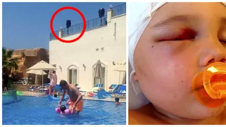 O boxa mare a cazut de la balconul unui hotel in capul unui copil de 3 ani! Ce rani a suferit si de ce va fi despagubit la 18 ani