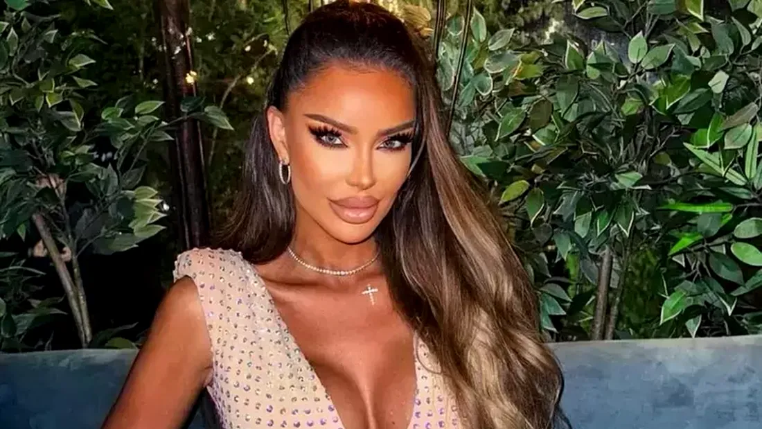 Bianca Drăgușanu și-a micșorat urechile. Vedeta a trecut printr-o nouă intervenție estetică și a dezvăluit ce urmează