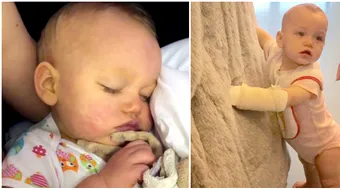 Si-a salvat fiica cu un clip video! Simptomul de septicemie prezent pe fata ei a alertat Facebook-ul VIDEO