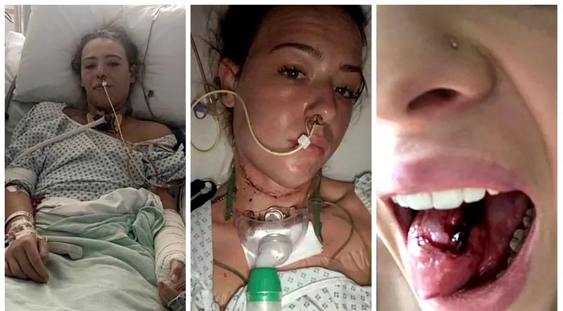 A fost diagnosticata cu ulcer in gura. Boala periculoasa pe care o avea, de fapt. Medicii nu si-au dat seama