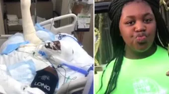 Trendul ciudat care raneste adolescentii! Isi dau foc pentru cateva like-uri pe Facebook