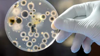 Candida auris, ciuperca molipsitoare care ne afecteaza din ce in ce mai des! Ce este