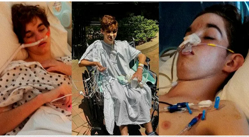 Adolescentul asta a aproape a murit si a petrecut 106 zile pe patul de spital dupa ce a mancat cu pofta un sandvis. Medicii au marturisit ca niciodata nu au mai vazut asa ceva