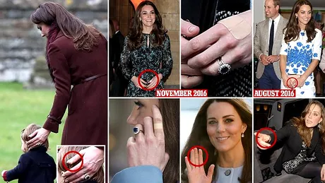 Kate Middleton are tot timpul degetele bandajate. De ce apare asa in public viitoarea regina