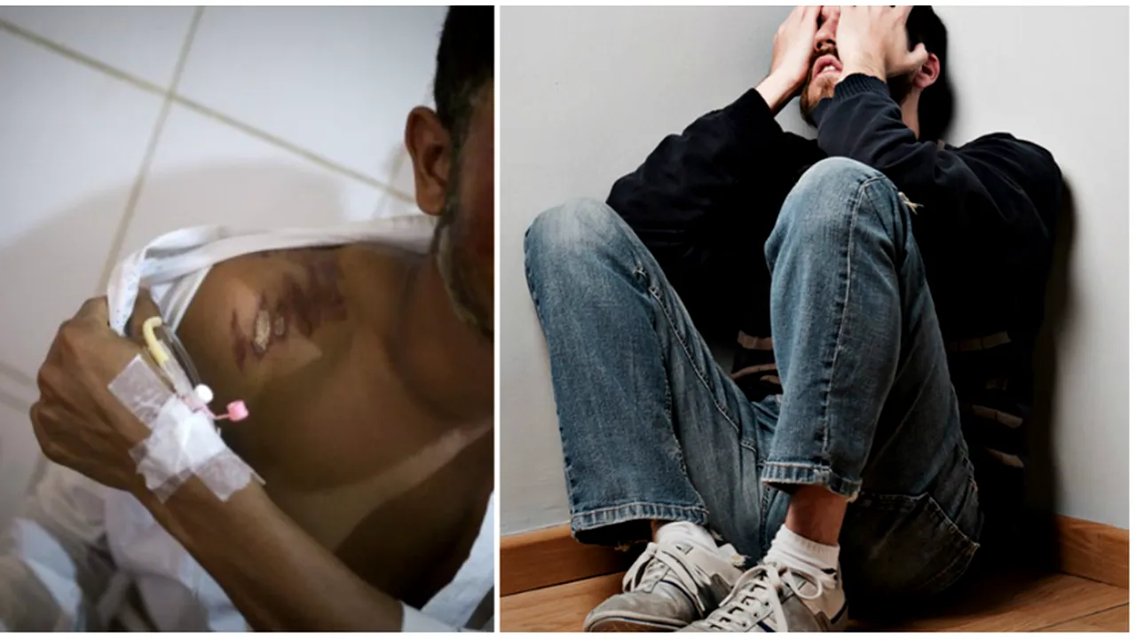 Adolescentul a ajuns sa arate groaznic dupa ce o tanara i-a aruncat cu acid pe fata 