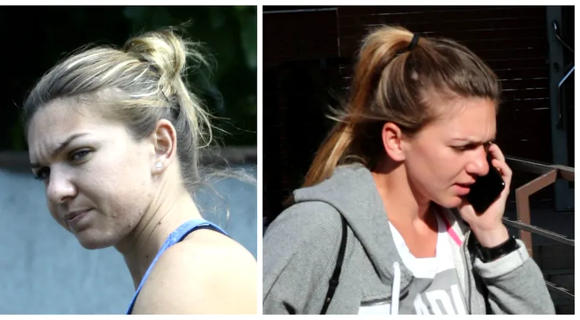 Pe fața Simonei Halep a răsărit soarele! Vedeta nu mai are probleme cu acneea