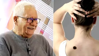 Ce semnificație au semnele din naștere, de fapt. Mihai Voropchievici le-a descifrat: ”Apar la oamenii aleși”