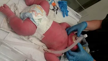 O femeie a nascut un bebe de 7 kg! Micutul poarta haine pentru copii de 6 luni, dar nu va intra in Cartea Recordurilor. De ce