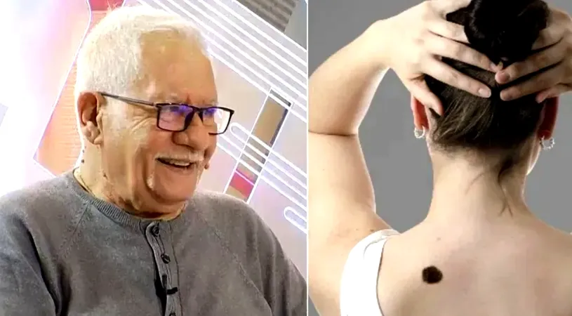 Ce semnificație au semnele din naștere, de fapt. Mihai Voropchievici le-a descifrat: ”Apar la oamenii aleși”