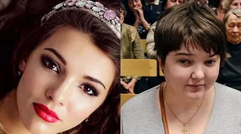 Nu-ti vine sa crezi ca e una si aceeasi persoana! Tanara asta superba a ajuns sa arate asa din cauza iubitului! Ce i-a facut barbatul de a ajuns in asemenea hal