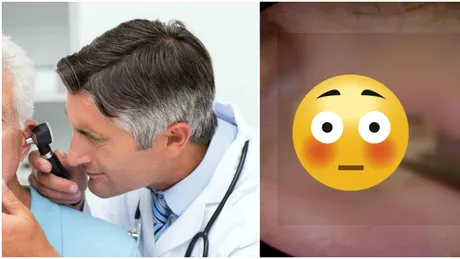 A trait timp de doi ani cu un obiect in ureche! Medicul s-a ingrozit cand a vazut si a filmat totul. Imaginile VIDEO sunt socante