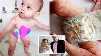 Nu mai pupati bebelusii! Micuta aceasta era sa moara din cauza unui simplu pupic