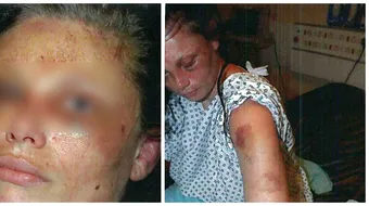 Gravida, batuta cu ciocane de iubit! Ororile la care barbatul a supus-o ore bune. Politia NU a facut nimic!!!