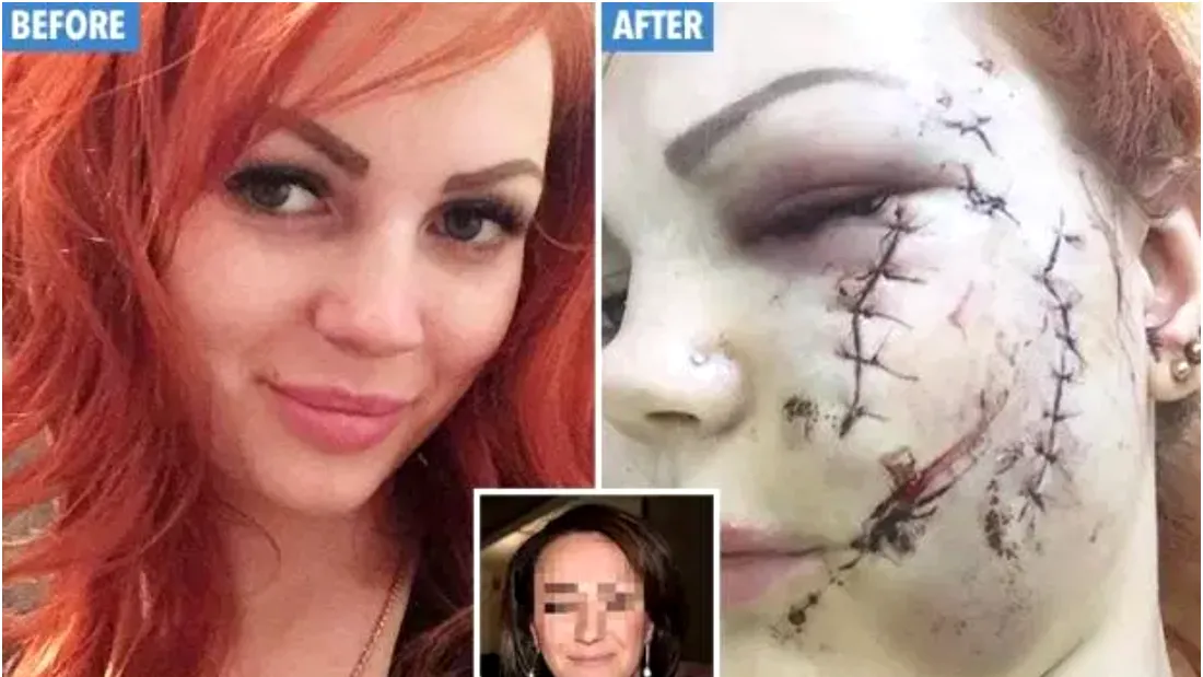 Femeia asta a fost mutilata pe viata dupa o seara la karaoke. Ce s-a intamplat! Imagini cutremuratoare