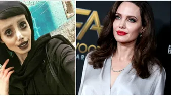 O mai tii minte pe adolescenta care a vrut sa devina sosia Angelinei Jolie? Semana cu un cadavru, dar acum s-a afisat toata naturala si e superba!
