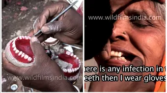Cum arata dentistii din India?! Stau pe marginea drumului, scot dintii pacientilor si tot acolo pun altii la loc pe care ii fac… in cateva minute VIDEO