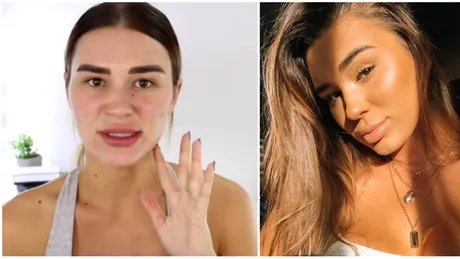 Bloggerita asta le-a aratat tuturor femeilor cel mai tare truc! Asa scapa de acnee in doar 5 minute, fara fond de ten VIDEO