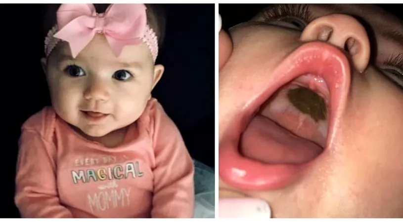 A descoperit o pata neagra in gura fiicei sale. A ajuns de rasul unui spital intreg cand medicii au aflat CE e, de fapt