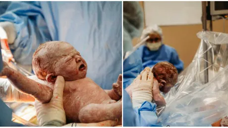 WOW! Si-a facut operatie de cezariana de una singura. Momentul in care mamica asta isi scoate bebelusul din pantece e cu adevarat incredibil VIDEO