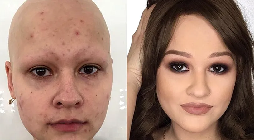 Cele mai ULUITOARE transformari prin machiaj! Femeile astea greu incercate de viata au fost schimbate RADICAL!