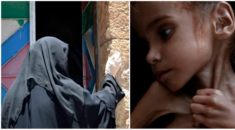 A murit fetita de 7 ani care a impresionat intreaga planeta pana la lacrimi! Devenise simbolul crizei din Yemen si era doar piele si os