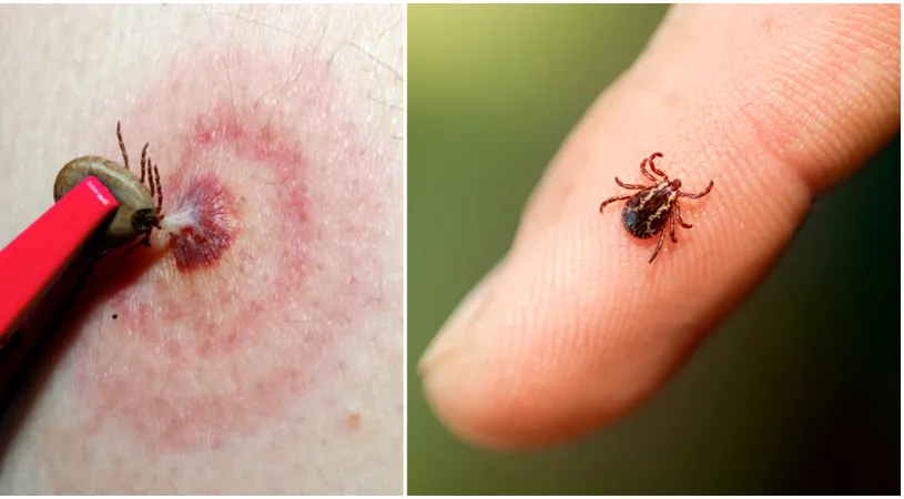 Cat de periculoase sunt muscaturile de capusa! Ce boala grava transmit insectele si care sunt primele semne