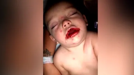 Un baietel de un an a ajuns la spital in stare grava! Ce i-a aparut in jurul gurii! Mama lui e disperata: Aveti grija cine va atinge copilul!