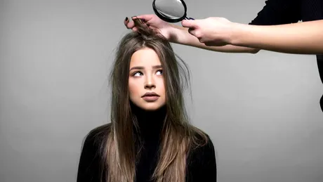 Remedii naturiste care te scapă de mătreață. Renunță la șampoanele scumpe!