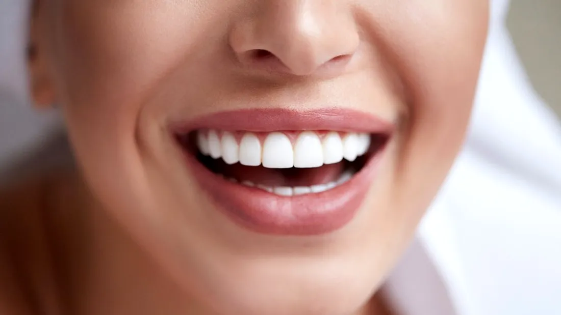 Fațetele din compozit, metoda non-invazivă care te ajută să ai dinți perfecți