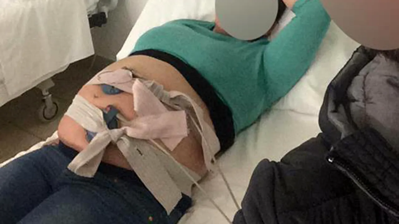 Bebelus 'macrosom' in Botosani. Ce spun medicii despre acest fat inedit din Romania (2) 