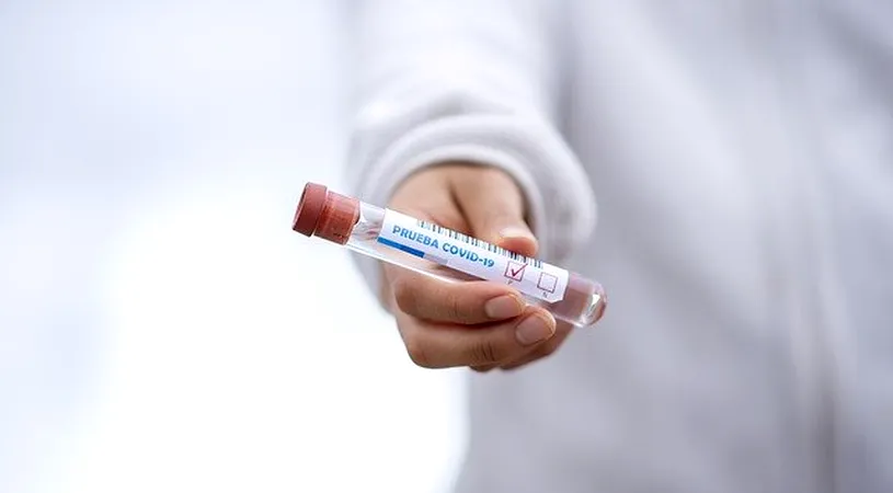 Teste gratuite la farmacii și cabinete dentare pentru noul coronavirus! Orașul unde se pot face acestea