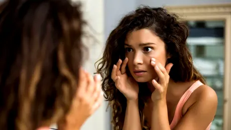 10 remedii naturale și ieftine care te scapă de cearcăne