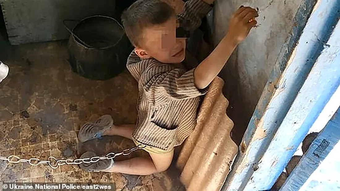 Imagini de groaza! Un baietel de 6 ani legat cu lanturi ca un caine de tatal lui si batut in ultimul hal!