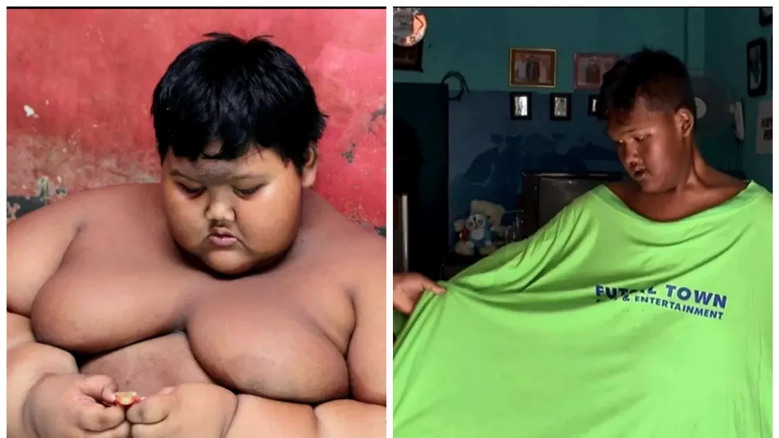 La 11 ani avea 190 de kilograme si toata lumea credea ca va muri din cauza obezitatii! A renuntat la zahar si a slabit 95 de kilograme! Cum arata acum cel mai gras copil din lume?