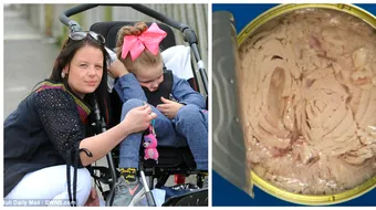 O fetita de 8 ani nu mai poate vorbi sau merge dupa ce a mancat ton la conserva. Ce a imbolnavit-o atat de grav