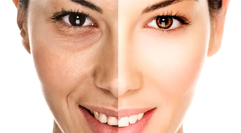 Regenerarea si intinerirea tenului cu o reteta veche de 500 de ani! Masca ideala pentru un chip vesnic tanar