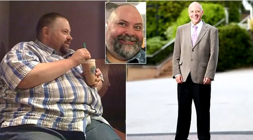 Incredibil! A slabit 127 de kilograme fara sa-si faca nicio operatie la stomac! Exemplul lui te va motiva si pe tine sa slabesti! Efortul a fost urias
