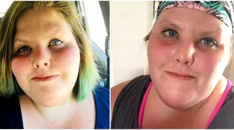 Tanara din imagini sufera de o maladie rara si are dureri ingrozitoare. E socant ce au inceput parintii sa tina ascuns sub lacat de frica ei